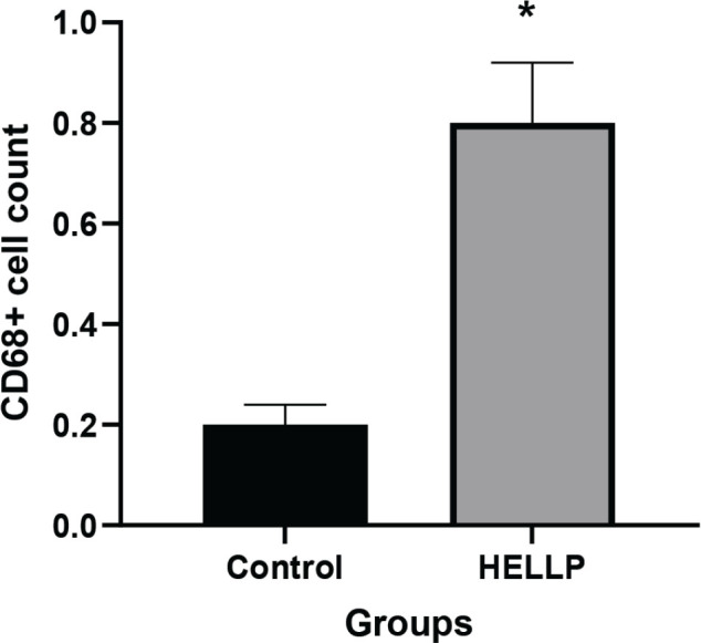 Severe preeclampsia complicated by HELLP syndrome alters the structure of Hofbauer and syncytiotrophoblast cells: ultrastructural and immunohistochemical study.