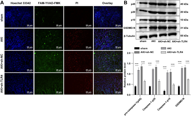 Toll-like receptor 4 promotes the inflammatory response in septic acute kidney injury by promoting p38 mitogen-activated protein kinase phosphorylation.