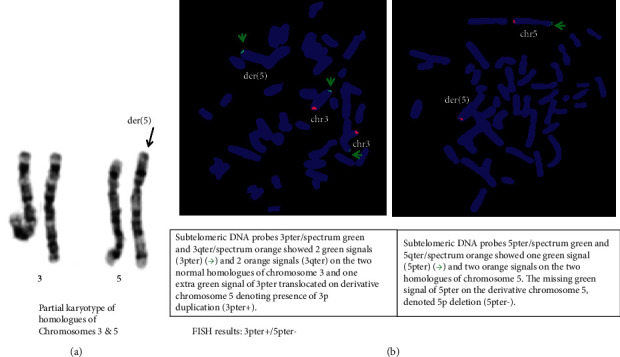 A Rare Case of Mosaic 3pter and 5pter Deletion-Duplication with Autism Spectrum Disorder and Dyskinesia.