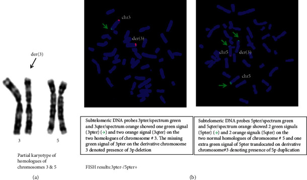 A Rare Case of Mosaic 3pter and 5pter Deletion-Duplication with Autism Spectrum Disorder and Dyskinesia.