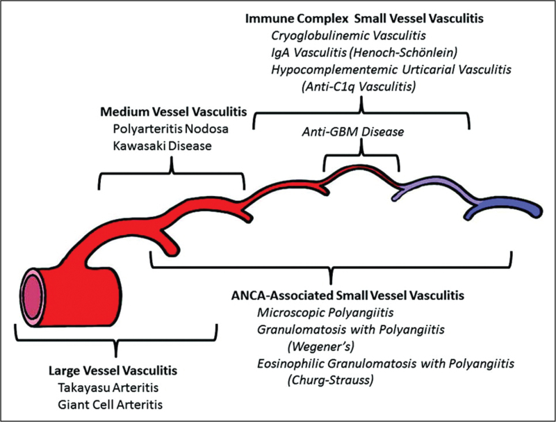 Systemic vasculitis and headache.