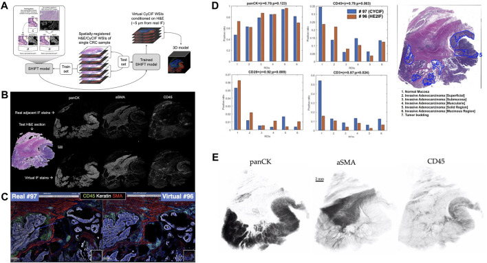 3D multiplexed tissue imaging reconstruction and optimized region of interest (ROI) selection through deep learning model of channels embedding.