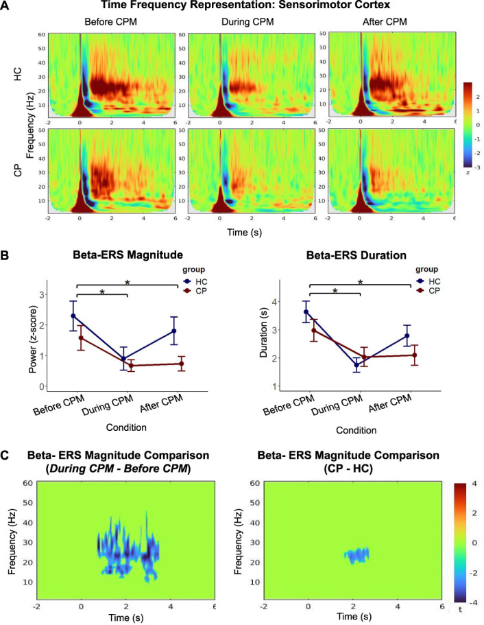 Neurophysiological oscillatory markers of hypoalgesia in conditioned pain modulation.