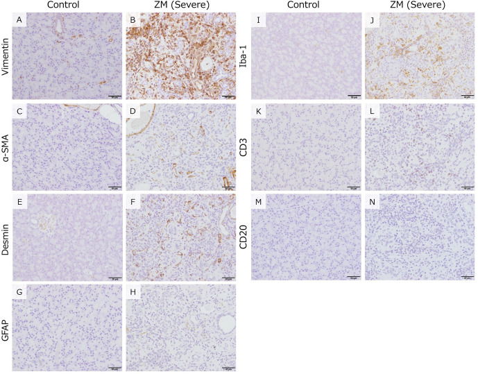 Pathological analysis of lesions in the exocrine pancreas of rats induced by Zinc Maltol.