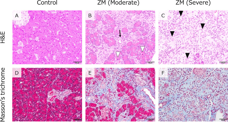 Pathological analysis of lesions in the exocrine pancreas of rats induced by Zinc Maltol.