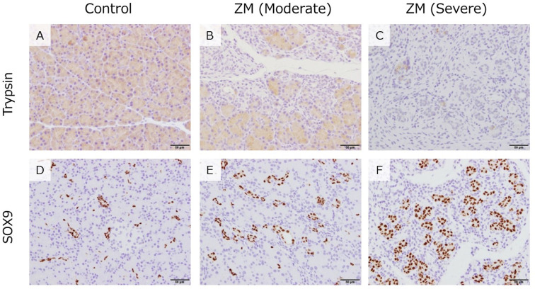 Pathological analysis of lesions in the exocrine pancreas of rats induced by Zinc Maltol.