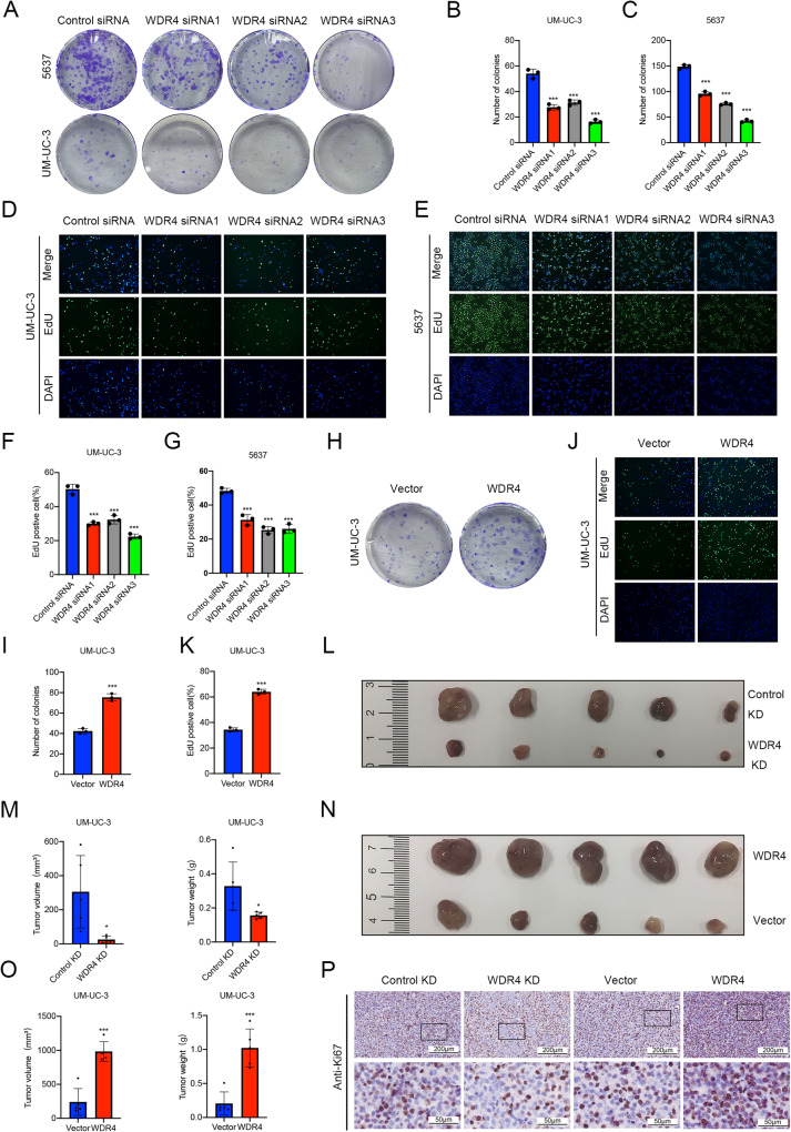 WDR4 promotes the progression and lymphatic metastasis of bladder cancer via transcriptional down-regulation of ARRB2.