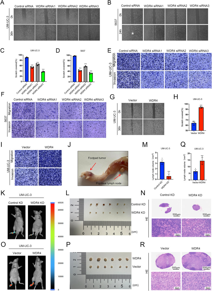 WDR4 promotes the progression and lymphatic metastasis of bladder cancer via transcriptional down-regulation of ARRB2.