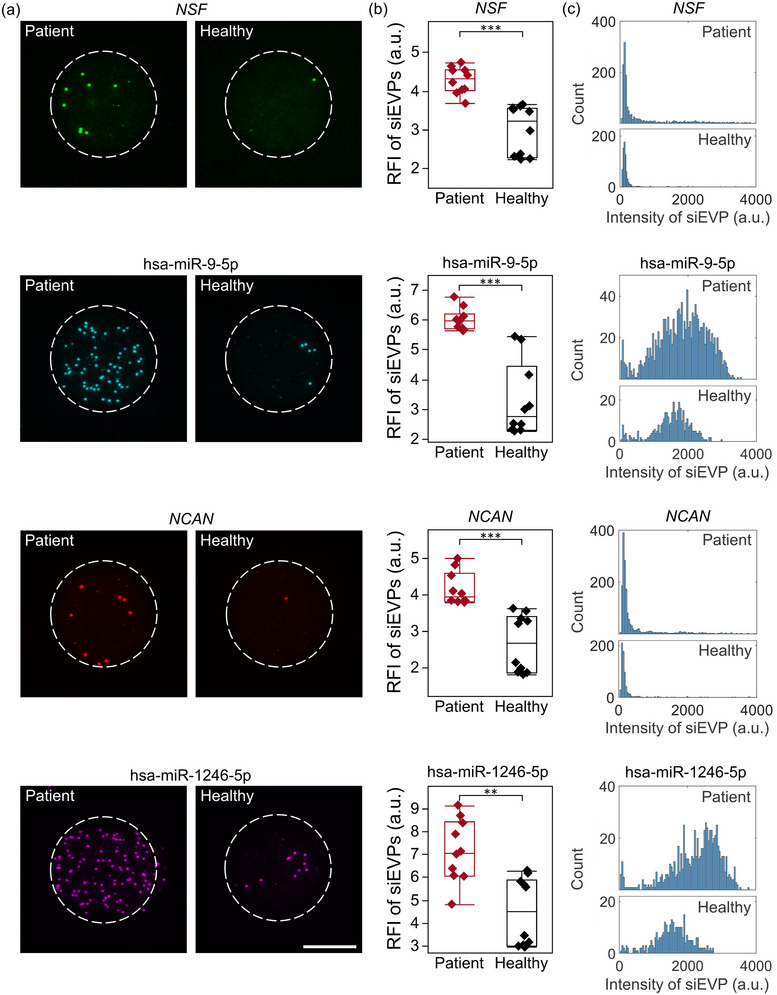 Engineering a tunable micropattern-array assay to sort single extracellular vesicles and particles to detect RNA and protein in situ