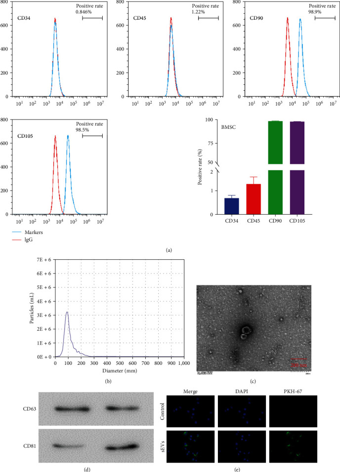 Bone Mesenchymal Stem Cell-Derived Small Extracellular Vesicles Ameliorated Lipopolysaccharide-Induced Lung Injury Via the miR-21-5p/PCSK6 Pathway.