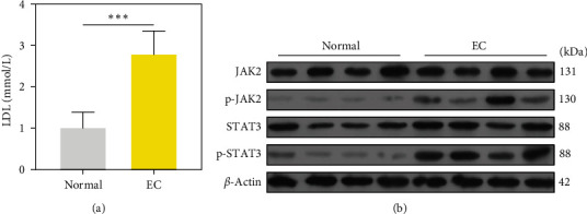 Low-Density Lipoprotein Contributes to Endometrial Carcinoma Cell Proliferation, Migration, and Invasion by Activating the JAK-STAT Signaling Pathway.