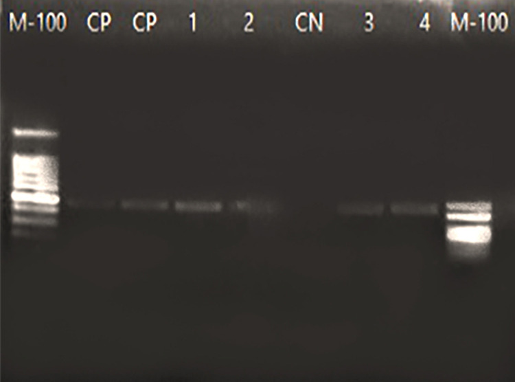 Genetic variability of Leishmania (Leishmania) infantum causing human visceral leishmaniasis in the Southeastern Brazil.