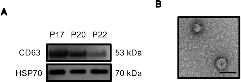 Global analyses and potential effects of extracellular vesicles on the establishment of conceptus implantation during the peri-implantation period.