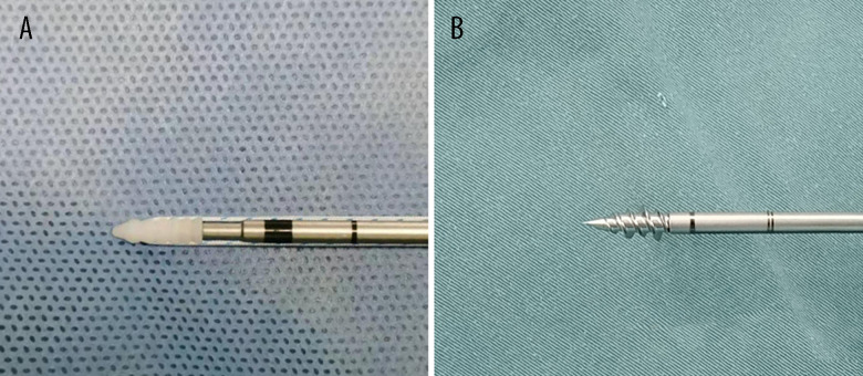 Comparative Evaluation of Metallic and Biodegradable Suture Anchors in Arthroscopic Repair of Anterior Talofibular Ligament Injury: A Short-term Study on Clinical and Functional Outcomes.