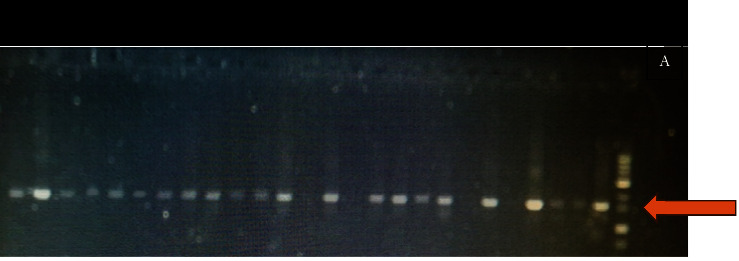 Characterization of Potential Probiotic Activity of Lactic Acid Bacteria Isolated from Camel Colostrum by Biochemical and Molecular Methods.