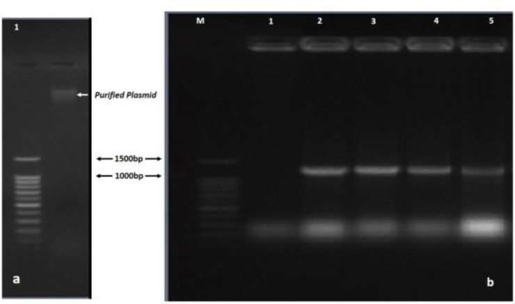 Improvement the expression and purification of Loa22: a lipoprotein with OmpA domain from pathogenic <i>Leptospira</i> serovars.