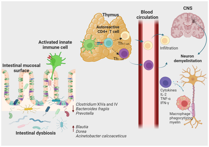 Association of intestinal dysbiosis with susceptibility to multiple sclerosis: Evidence from different population studies (Review).