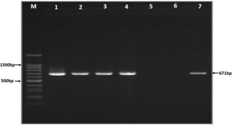 Improvement the expression and purification of Loa22: a lipoprotein with OmpA domain from pathogenic <i>Leptospira</i> serovars.