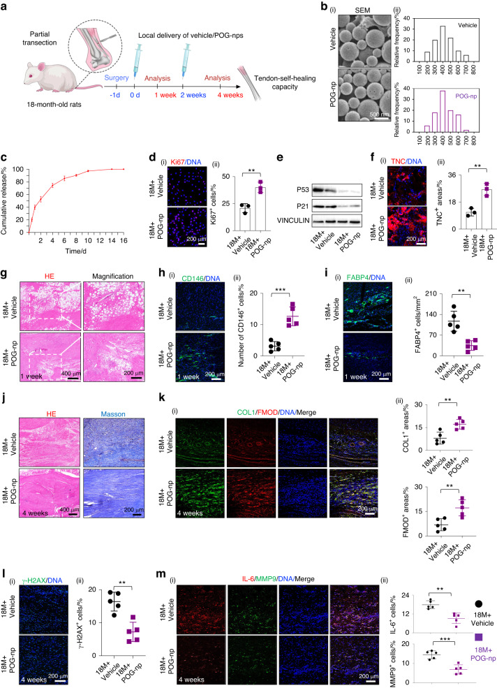 Prim-O-glucosylcimifugin ameliorates aging-impaired endogenous tendon regeneration by rejuvenating senescent tendon stem/progenitor cells.