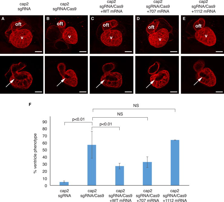 Rare variants in <i>CAPN2</i> increase risk for isolated hypoplastic left heart syndrome.