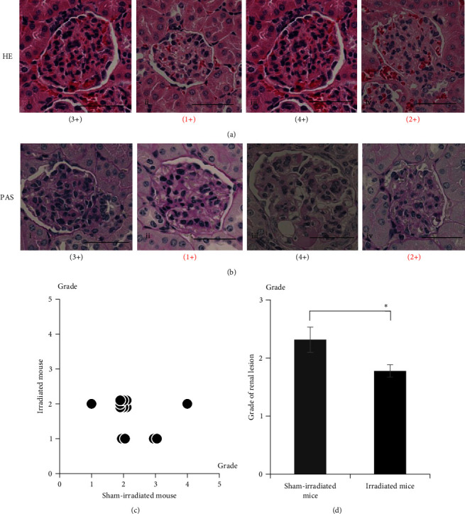 Irradiation Attenuates Systemic Lupus Erythematosus-Like Morbidity in NZBWF1 Mice: Focusing on CD180-Negative Cells.