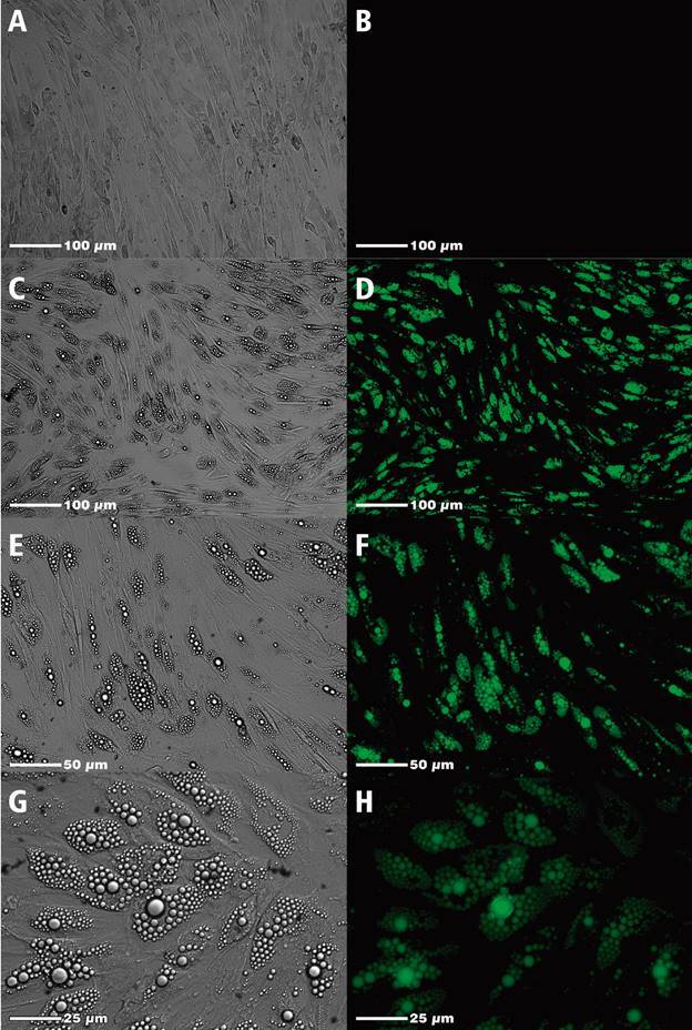 Benznidazole treatment decreases IL-6 levels in Trypanosoma cruzi-infected human adipocytes differentiated from adipose tissue-derived stem cells.