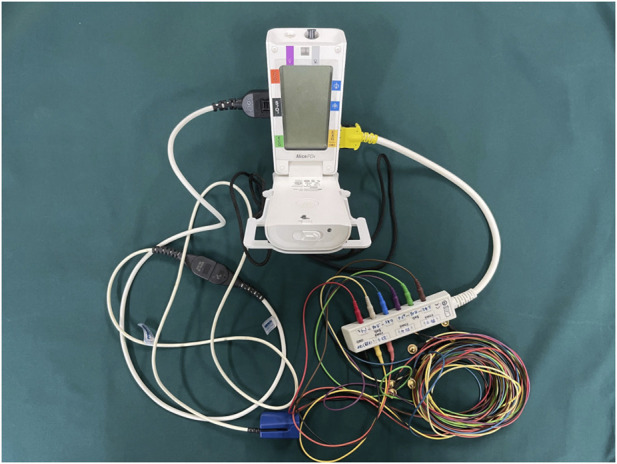 Clinical observation of dexmedetomidine nasal spray in the treatment of sleep disorders on the first night after undergoing maxillofacial surgery: a single-center double-blind randomized controlled study.