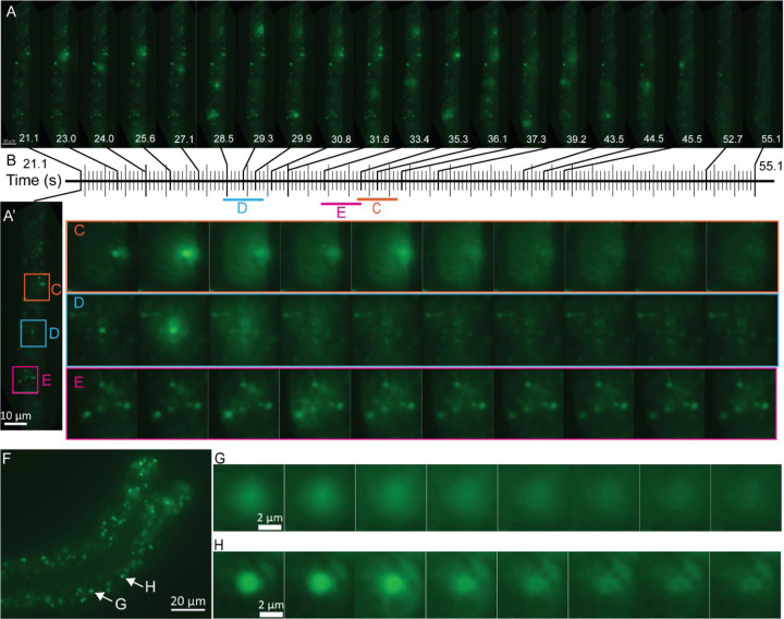 Blue light stimulated-autofluorescence green flash of lysosome-related organelles in the intestinal cells of nematodes.