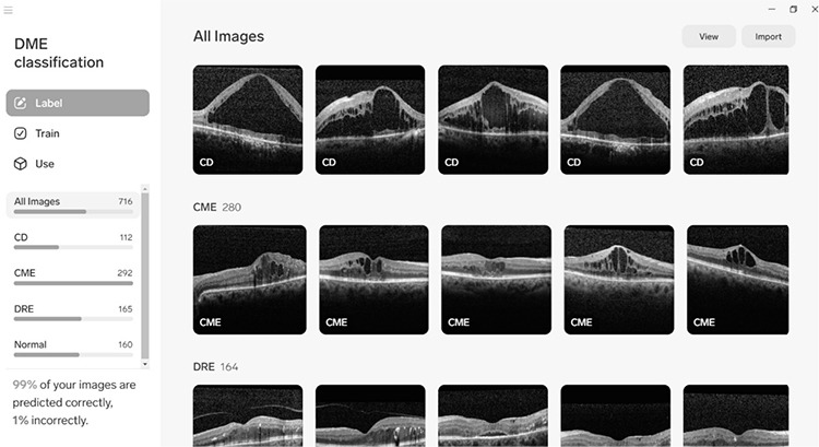 Detection and Classification of Diabetic Macular Edema with a Desktop-Based Code-Free Machine Learning Tool.