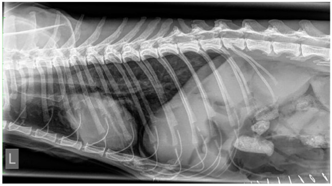 Resolution of megaesophagus after correction of a paraesophageal hernia.