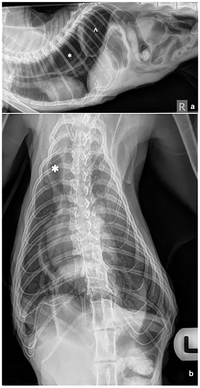 Resolution of megaesophagus after correction of a paraesophageal hernia.