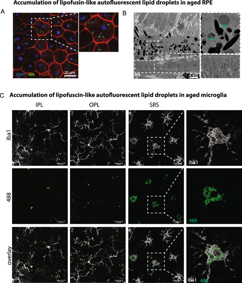 Microglia preserve visual function loss in the aging retina by supporting retinal pigment epithelial health.