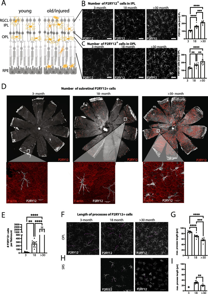 Microglia preserve visual function loss in the aging retina by supporting retinal pigment epithelial health.