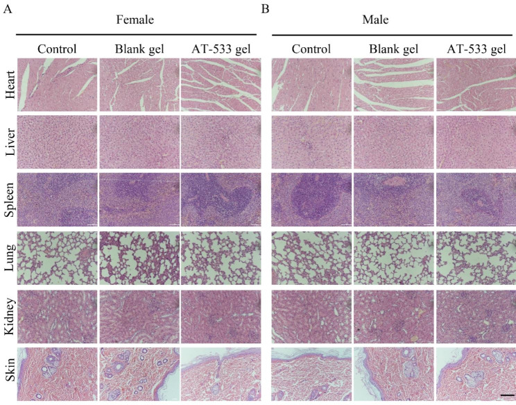 Acute toxicological evaluation of AT-533 and AT-533 gel in Sprague-Dawley rats.