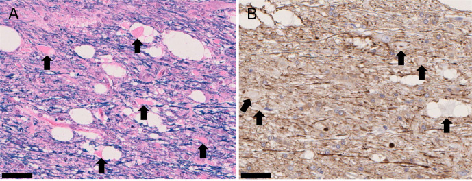 Identifying the dataset to define the optimal timing of histopathological examination for central nervous system toxicity in MPTP-induced Parkinson's disease monkey model.