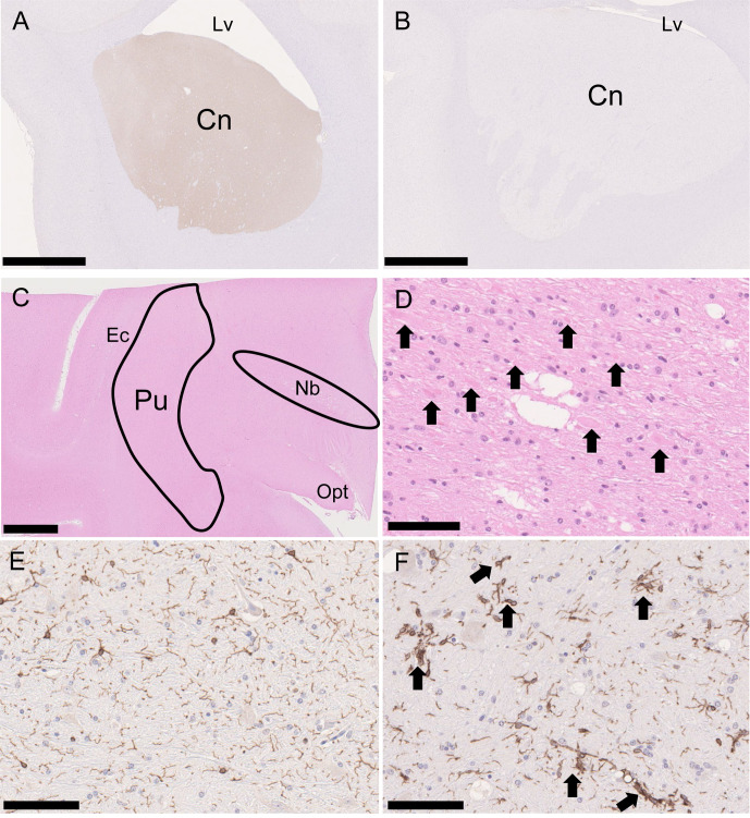 Identifying the dataset to define the optimal timing of histopathological examination for central nervous system toxicity in MPTP-induced Parkinson's disease monkey model.