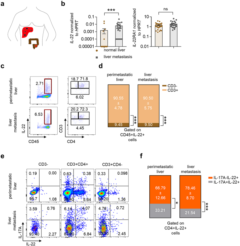 CD4+ T cell-derived IL-22 enhances liver metastasis by promoting angiogenesis.