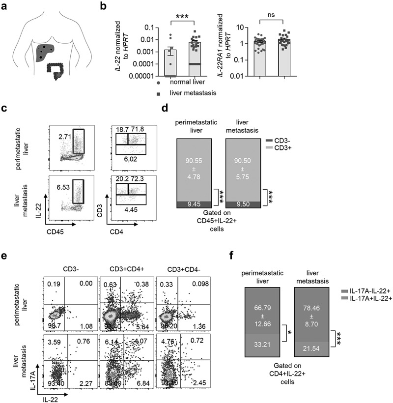 CD4+ T cell-derived IL-22 enhances liver metastasis by promoting angiogenesis.