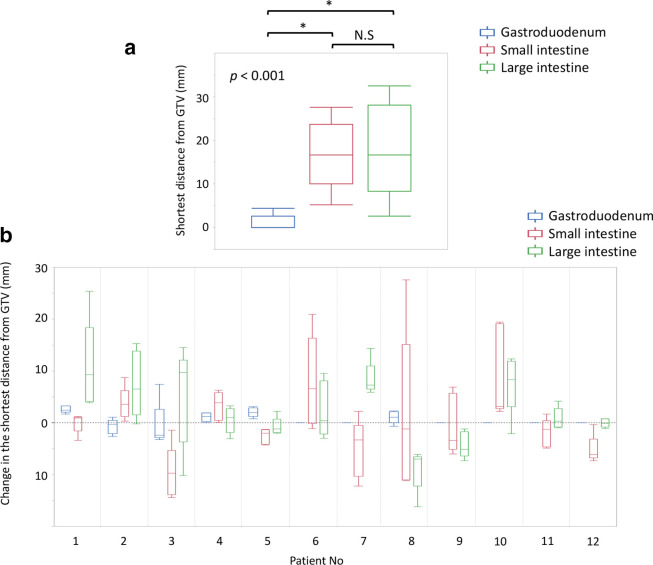 Predicting the daily gastrointestinal doses of stereotactic body radiation therapy for pancreatic cancer based on the shortest distance between the tumor and the gastrointestinal tract using daily computed tomography images.