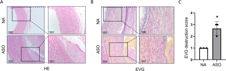 Microarray Expression Profile and Bioinformatic Analysis of Circular RNA in Human Arteriosclerosis Obliterans.