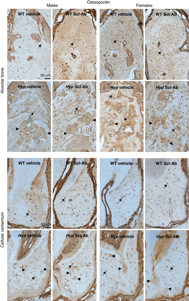 Sclerostin antibody improves alveolar bone quality in the Hyp mouse model of X-linked hypophosphatemia (XLH).