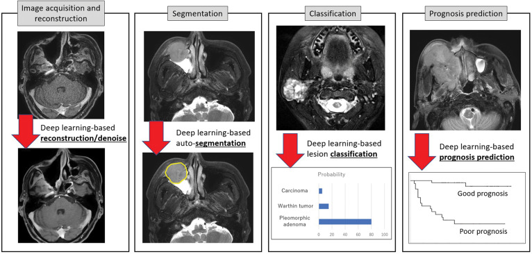 Current State of Artificial Intelligence in Clinical Applications for Head and Neck MR Imaging.