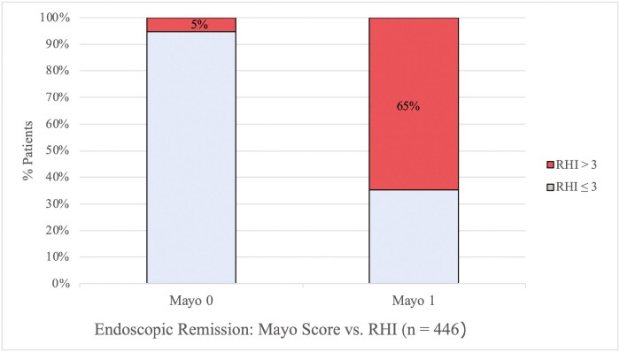 Histologic Inflammation can Predict Future Clinical Relapse in Ulcerative Colitis Patients in Endoscopic Remission.