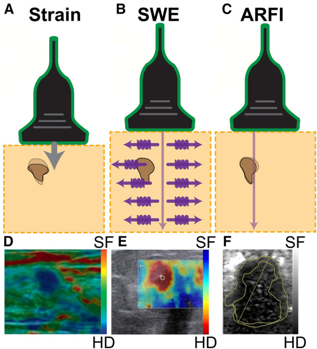 Visualizing tactile feedback: an overview of current technologies with a focus on ultrasound elastography.