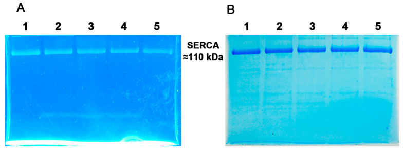 Isolation of the Sarcoplasmic Reticulum Ca<sup>2+</sup>-ATPase from Rabbit Fast-Twitch Muscle.