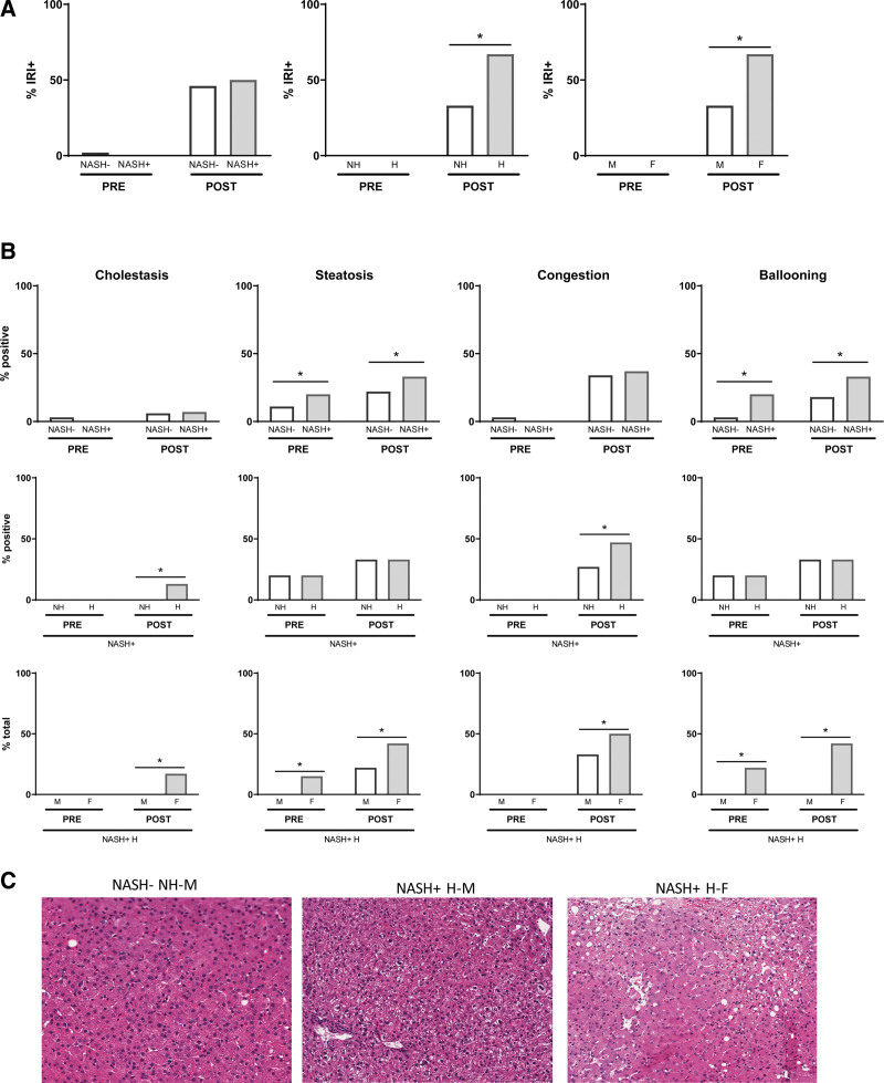 Immune Features of Disparate Liver Transplant Outcomes in Female Hispanics With Nonalcoholic Steatohepatitis.