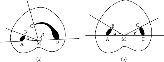 Prevalence and Morphology of C-Shaped Canals in Mandibular First and Second Molars of an Iranian Population: A Cone-Beam Computed Tomography Assessment.