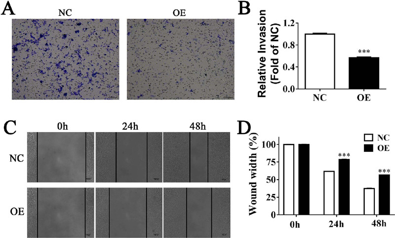 Transcriptomics Provides Novel Insights into the Regulatory Mechanism of IncRNA HIF1 A-AS1 on Vascular Smooth Muscle Cells.