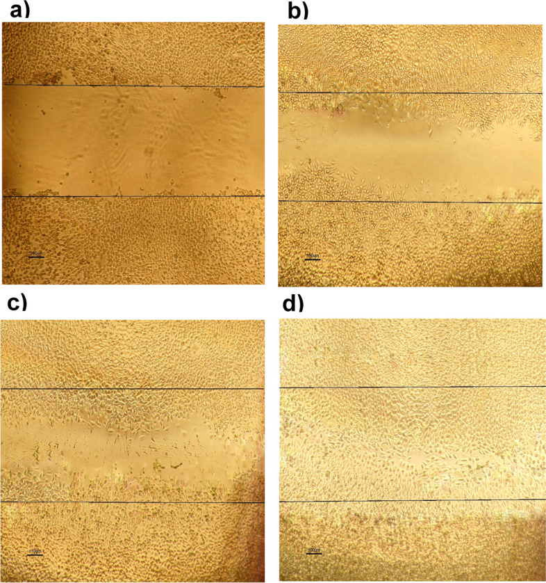 Dual-drug (Curcumin/Ciprofloxacin) loading and release from chitosan-based hydrogels embedded with magnetic Montmorillonite/Hyaluronic acid for enhancing wound healing.