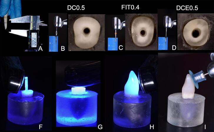 Survival of severely compromised endodontically treated teeth restored with or without a fiber glass post.